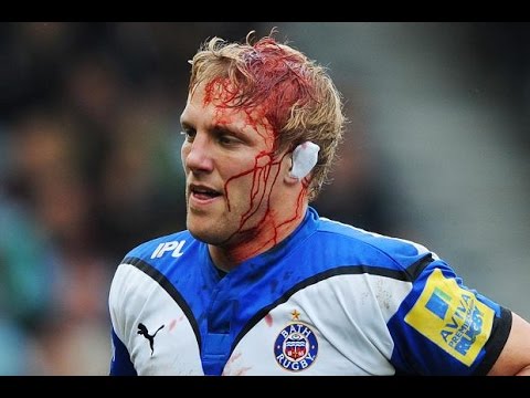 Preview Johnny Fisher: Ear Blood Clot Against Allen ‘Nothing Compared to Rugby Injuries’