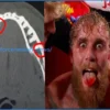 Jake Paul Gives Update on Double Broken Jaw and When He’ll Fight Again