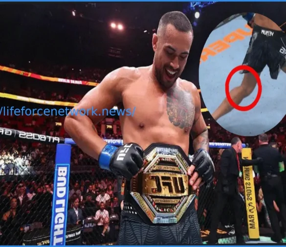 Carlos Ulberg’s Incredible UFC 327 Title Victory Despite Torn ACL and Tibia Damage