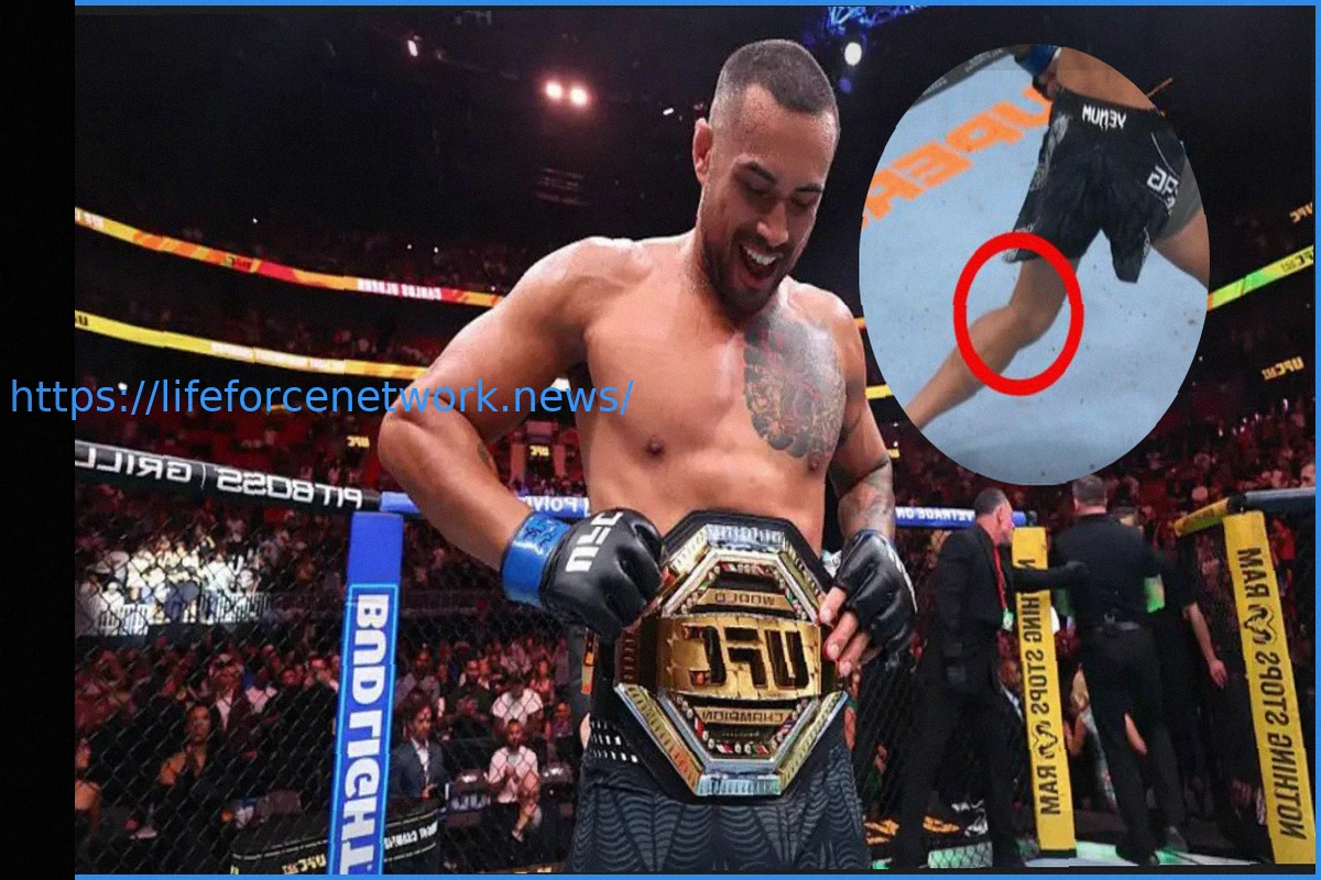 Preview Carlos Ulberg’s Incredible UFC 327 Title Victory Despite Torn ACL and Tibia Damage