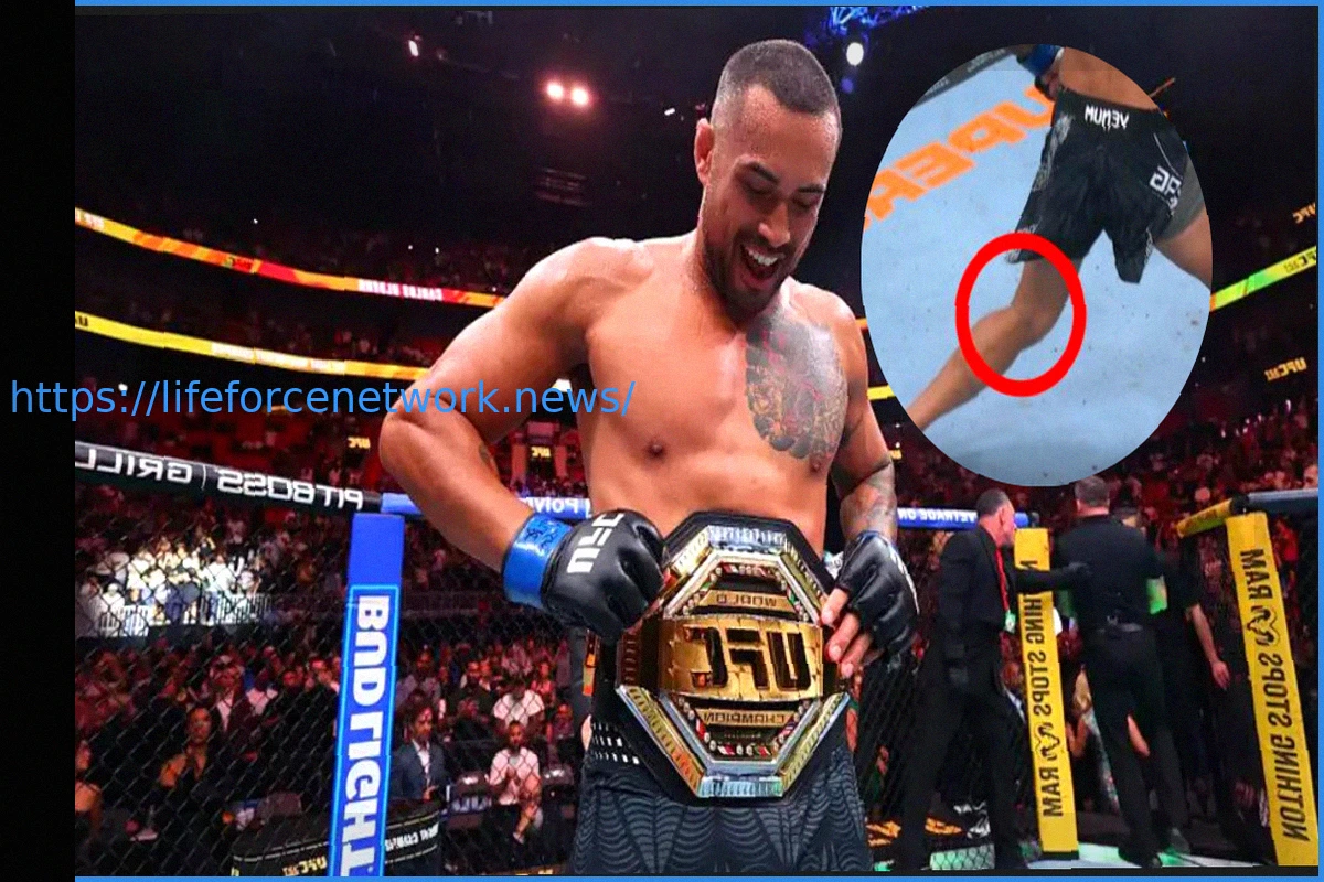 Preview Carlos Ulberg’s Incredible UFC Title Win Despite Torn ACL and Tibia Damage