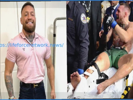 The Lingering Shadow: Could Conor McGregor’s Leg Break Still Haunt Him?
