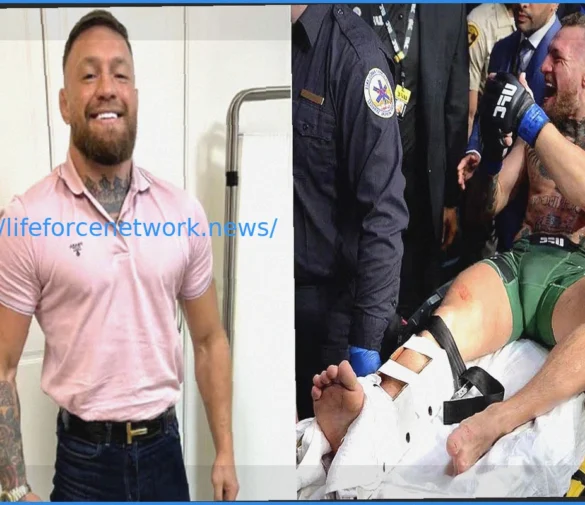 The Lingering Shadow: Could Conor McGregor’s Leg Break Still Haunt Him?