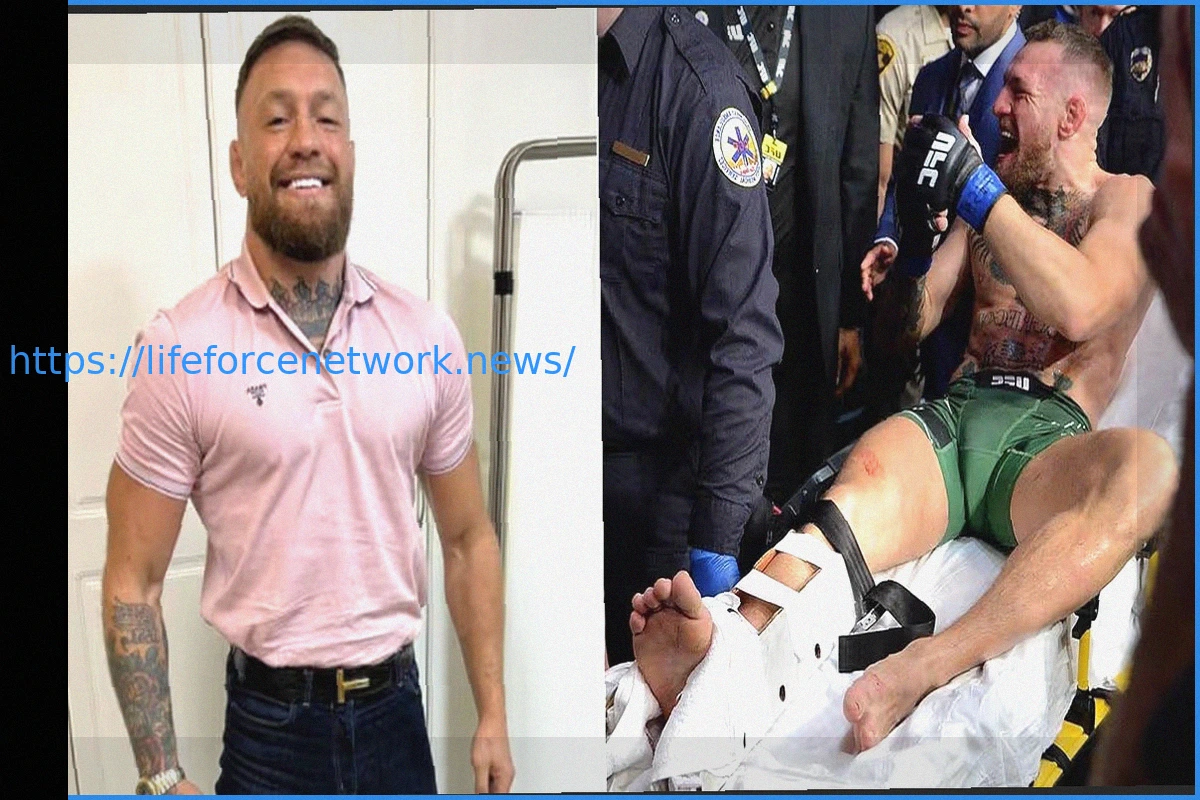 Preview The Lingering Shadow: Could Conor McGregor’s Leg Break Still Haunt Him?