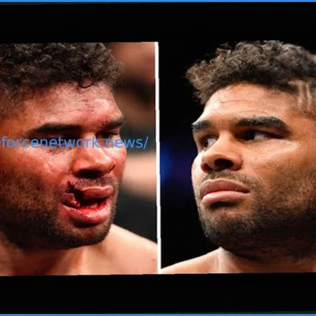 UFC спортсменка показала шокирующее видео: дренаж извлечен из глаза после травмы